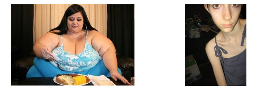 Vrouw met overgewicht en een te dunne vrouw